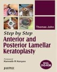 Step by Step Anterior and Posterior Lamellar Keratoplasty(with Dvd) by John