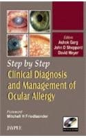 Step by Step Clinical Diagnosis and Management to Ocular Allergy