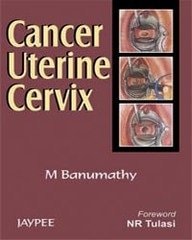 Cancer Uterine Cervix