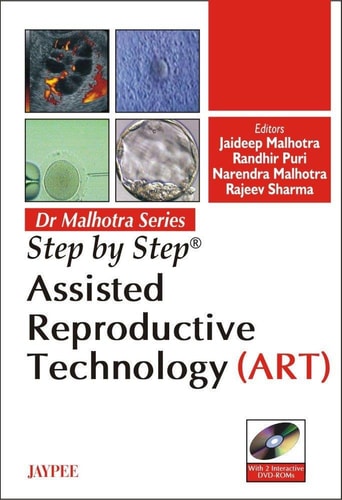 Assisted Reproductive Technology