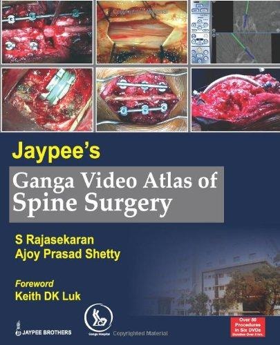 Jaypee's Ganga Video Atlas of Spine Surgery-zoom-1