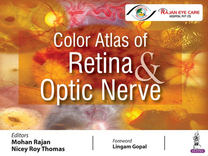 Color Atlas of Retina & Optic Nerve