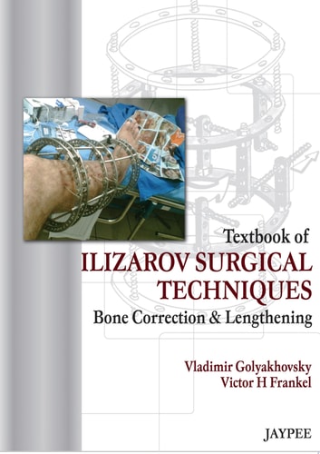 Textbook of Ilizarov Surgical Techniques: Bone Correction and Lengthening Bone Correction and Lengthening