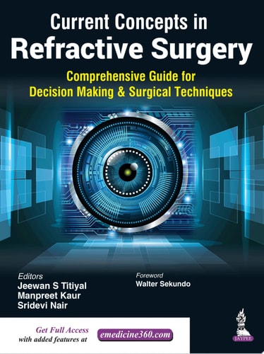 Current Concepts in Refractive Surgery Comprehensive Guide to Decision Making & Surgical Techniques
