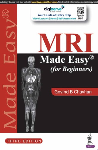 MRI Made Easy (for Beginners)