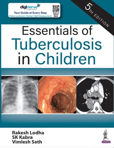 Essentials of Tuberculosis in Children