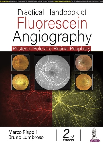 Practical Handbook of Fluorescein Angiography Posterior Pole and Retinal Periphery
