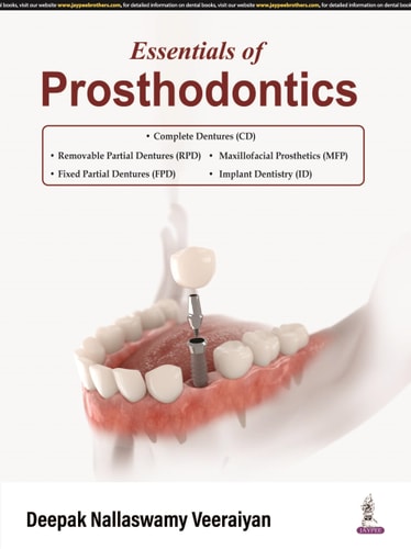 Essentials of Prosthodontics