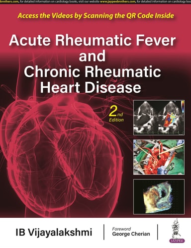 Acute Rheumatic Fever and Chronic Rheumatic Heart Disease