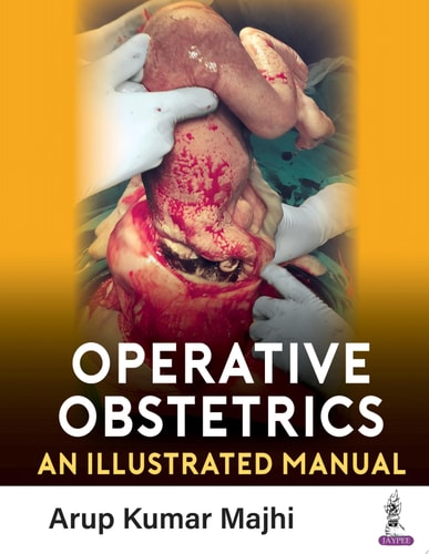 Operative Obstetrics An Illustrated Manual