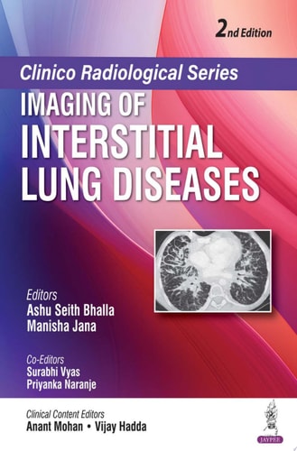 Clinico Radiological Series: Imaging of Interstitial Lung Diseases-1