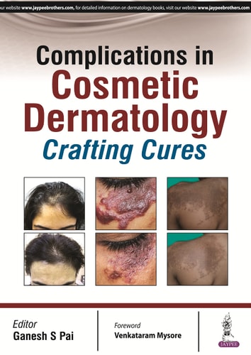 Complications in Cosmetic Dermatology Crafting Cures
