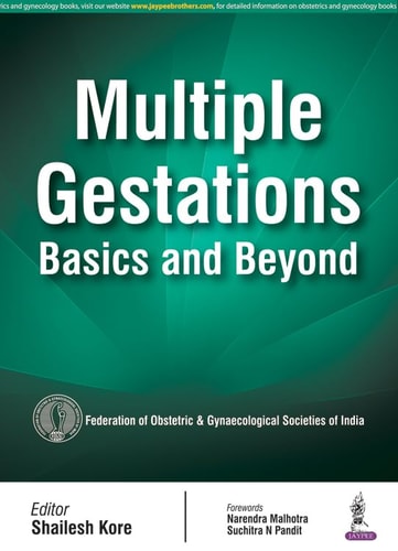 Multiple Gestations Basics and Beyond