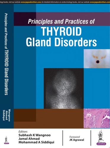 Principles and Practices of Thyroid Gland Disorders