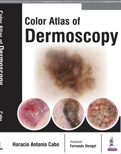 Color Atlas of Dermoscopy-zoom-1