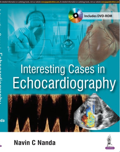 Interesting Cases in Echocardiography-zoom-