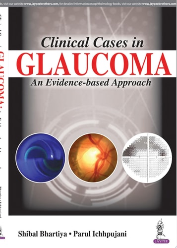 Clinical Cases in Glaucoma An Evidence Based Approach-zoom-