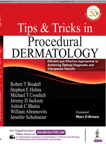 Office Procedural Tips & Tricks in Dermatology