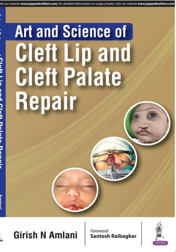 Art and Science of Cleft Lip and Cleft Palate Repair