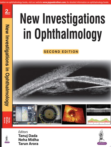 New Investigations in Ophthalmology-zoom-1
