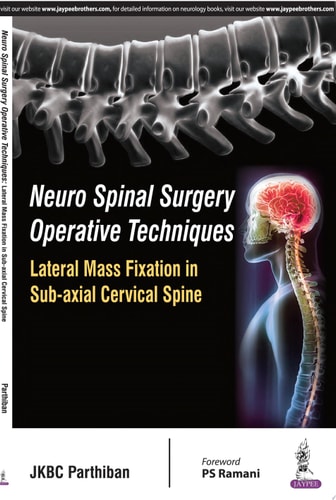 Neuro Spinal Surgery Operative Techniques: Lateral Mass Fixation in Sub-axial Cervical Spine