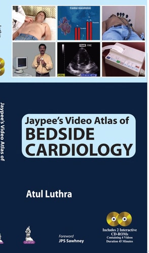 Jaypee's Video Atlas of Bedside Cardiology
