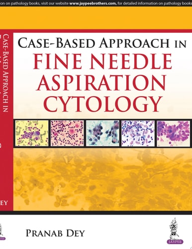 Case-Based Approach in Fine Needle Aspiration Cytology-zoom-1