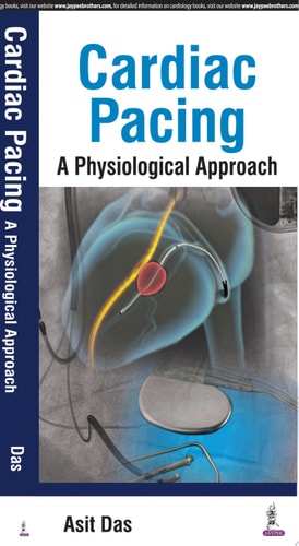 Cardiac Pacing A Physiological Approach