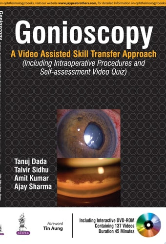 Gonioscopy A Video Assisted Skill Transfer Approach