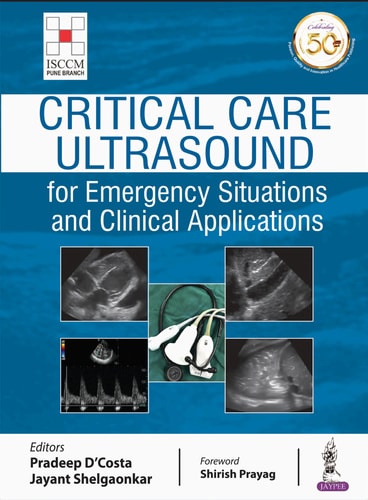 Critical Care Ultrasound for Emergency Situations and Clinical Applications