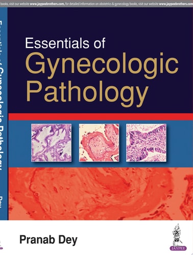 Essentials of Gynecologic Pathology-1