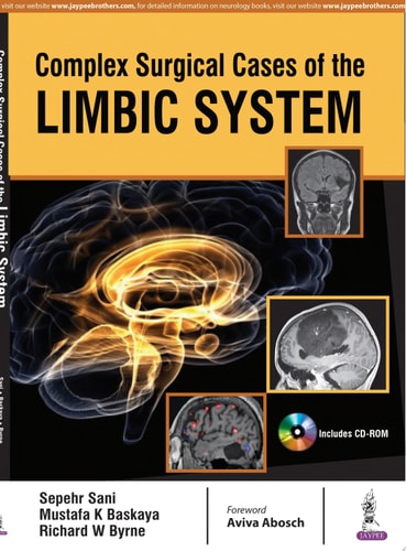 Complex Surgical Cases of the Limbic System-zoom-1