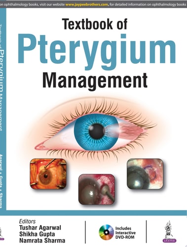 Textbook of Pterygium Management-zoom-1