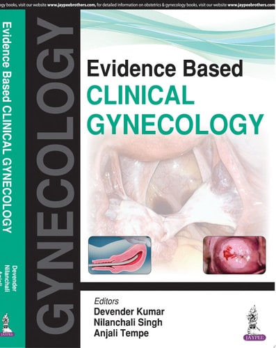 Evidence Based Clinical Gynecology-zoom-