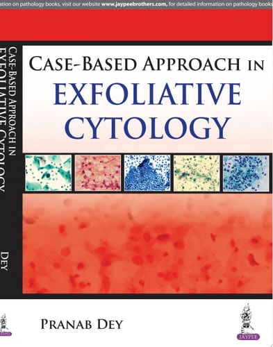 Case Based Approach in Exfoliative Cytology