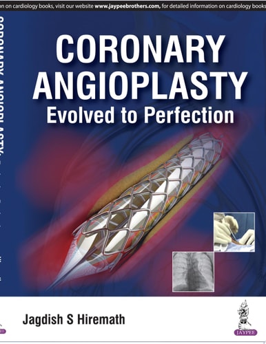 Coronary Angioplasty Evolved to Perfection-zoom-1