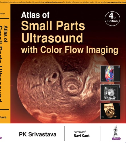 Atlas of Small Parts Ultrasound With Color Flow Imaging-1