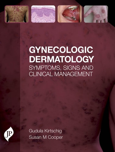 Gynecologic Dermatology Symptoms, Signs and Clinical Management-zoom-1
