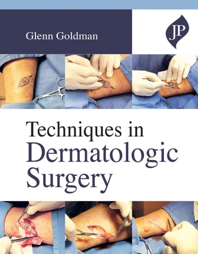 Techniques in Dermatologic Surgery