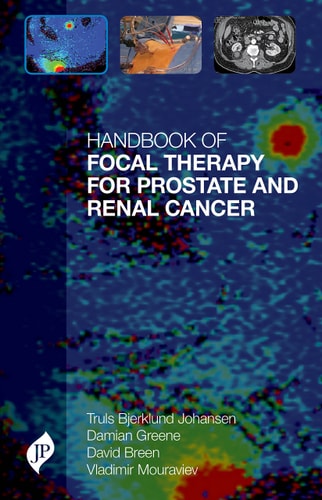 Handbook of Focal Therapy for Prostate and Renal Cancer-zoom-
