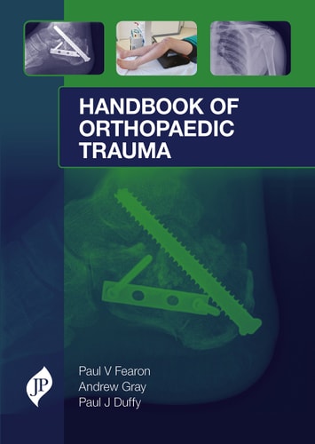 Handbook of Orthopaedic Trauma Surgical Management from Admission to Rehabilitation-zoom-