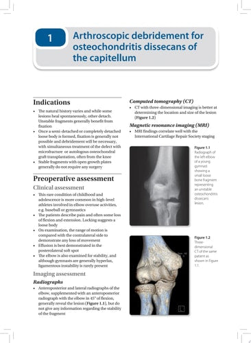 EFOST Surgical Techniques in Sports Medicine - Elbow Surgery