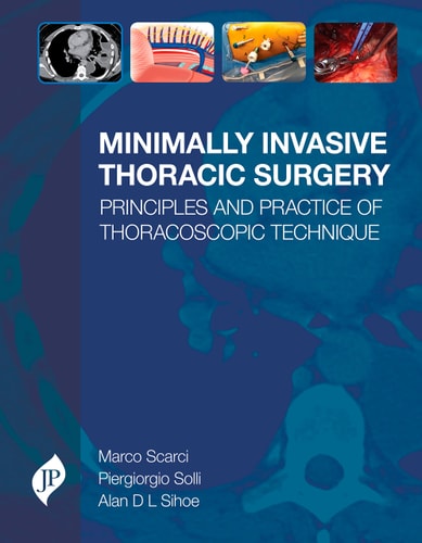 Minimally Invasive Thoracic Surgery Principles and Practice of Thoracoscopic Technique