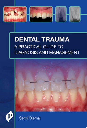 Dental Trauma A Practical Guide to Diagnosis and Management