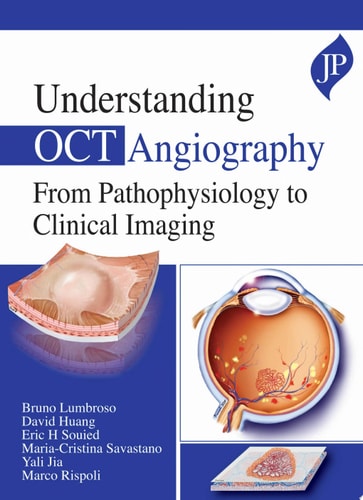 Understanding OCT Angiography From Pathophysiology to Clinical Imaging