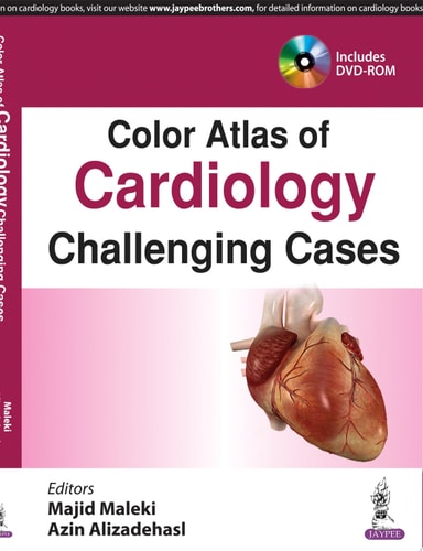 Color Atlas of Cardiology Challenging Cases