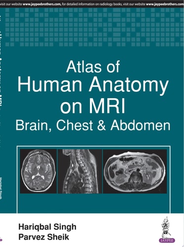 Atlas of Human Anatomy on MRI Brain, Chest & Abdomen