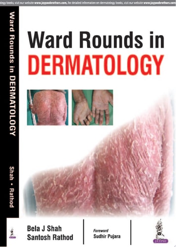 Ward Rounds in Dermatology