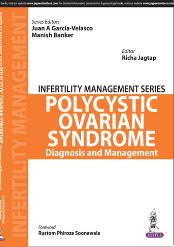 Decoding Polycystic Ovarian Syndrome-1