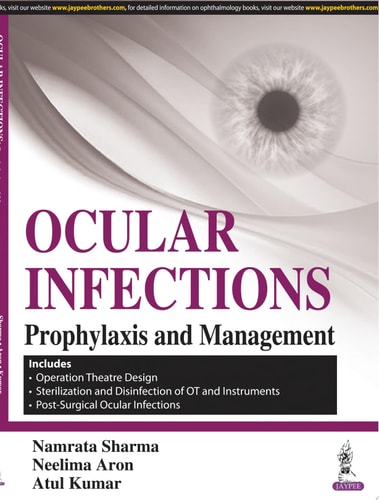 Ocular Infections Prophylaxis and Management